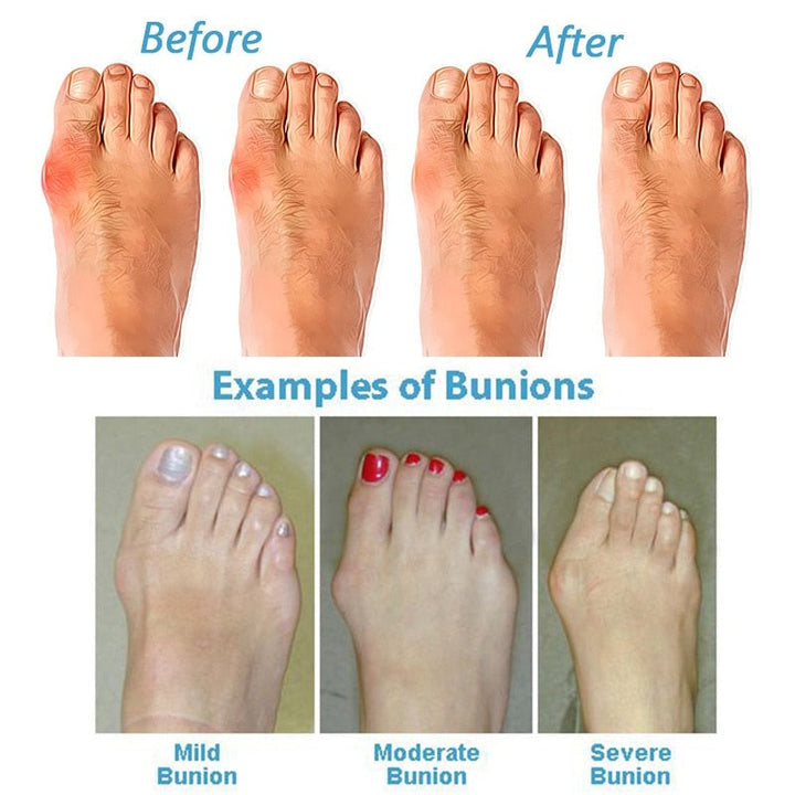 Myna - Comfortable Orthopaedic Sandals